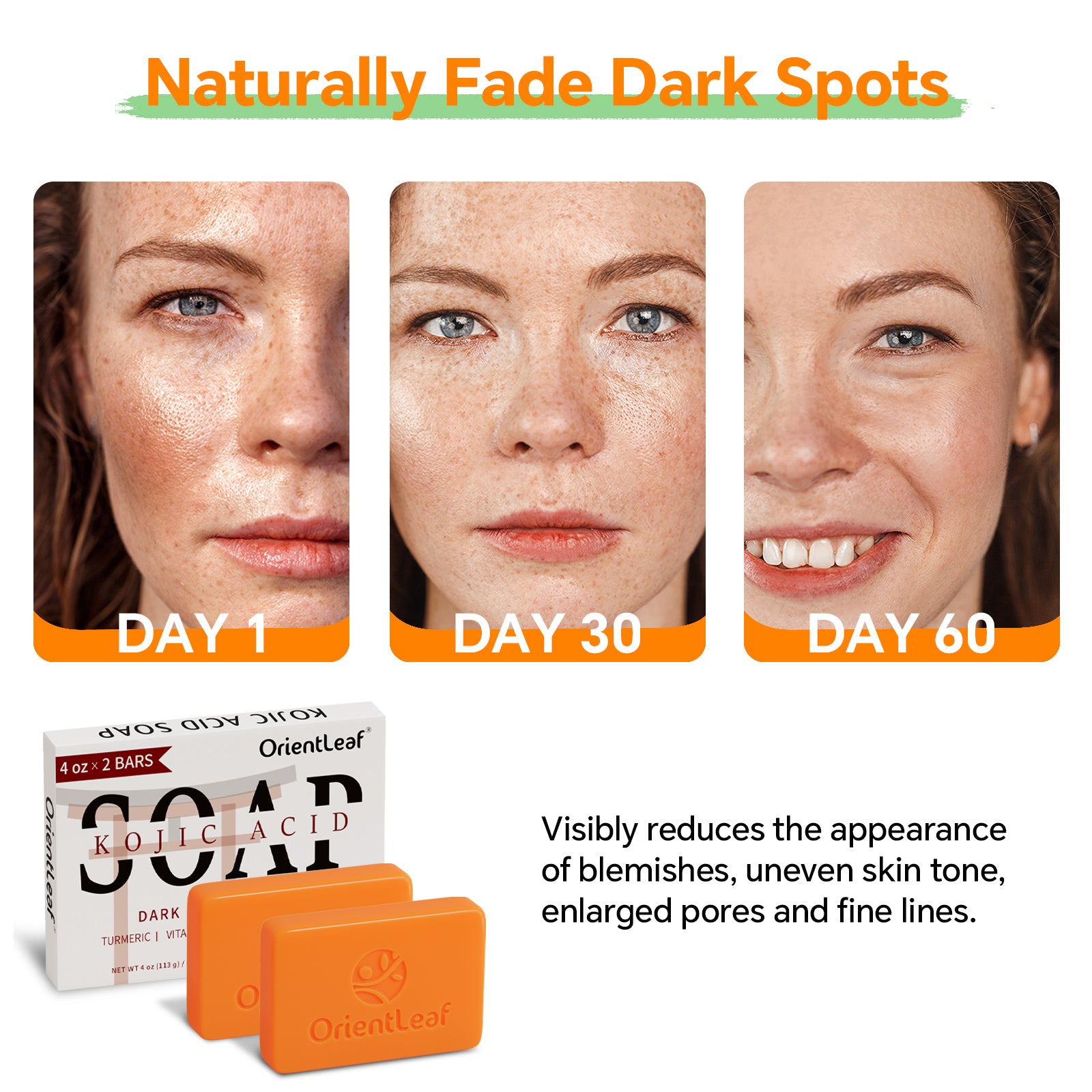 Kojic Acid Soap (4oz*2 PACK)